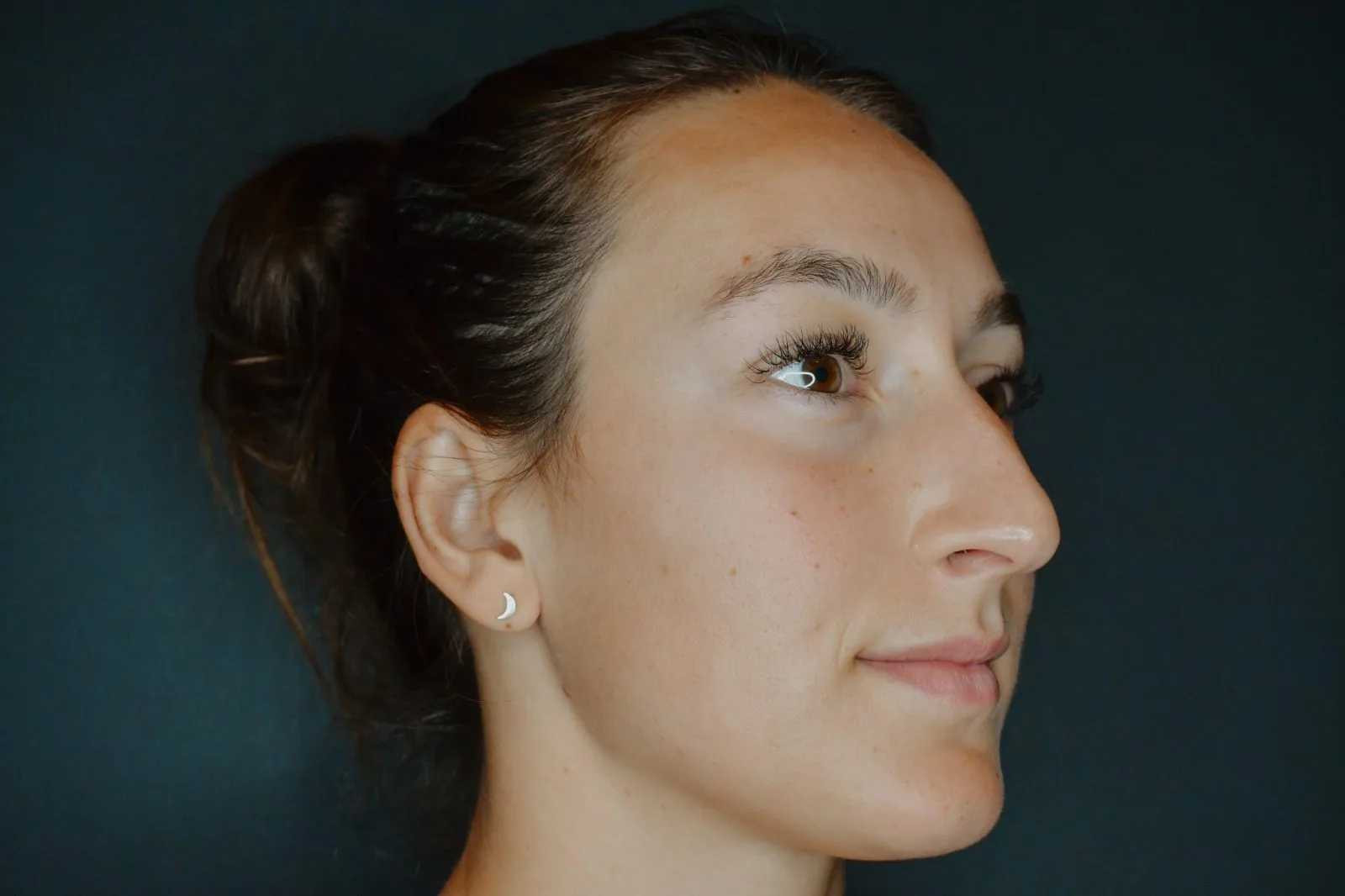 Woman's profile showing clear, smooth skin and facial contours